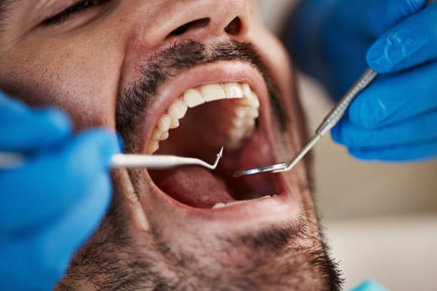Best Emergency Dental Services for Seniors in Raintree Plantation, MO